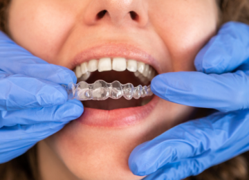 What Can Invisalign Fix? A Complete Guide for Paisley Patients 