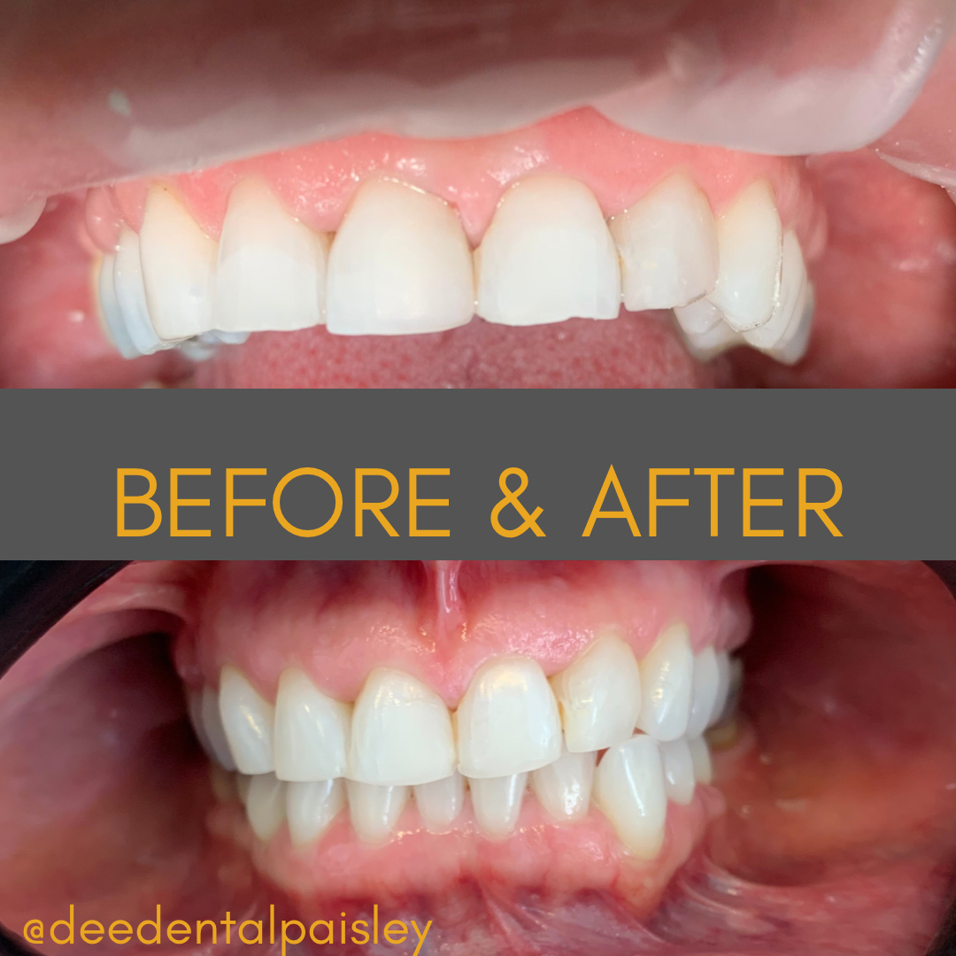 restorative dentistry work